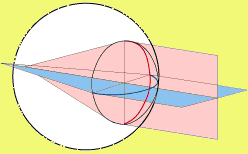 OCCHIO ASTIGMATICO: i raggi luminosi orizzontali vanno a fuoco dietro la retina, quelli verticali al davanti di essa
