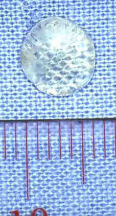 Cristallino umano. Si notino le dimensioni molto ridotte di questa lente. Ogni tacca del righello corrisponde ad un millimetro.